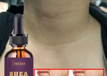 Effective Neck Lift Treatment for Smoother, Youthful Skin and Radiant Glow