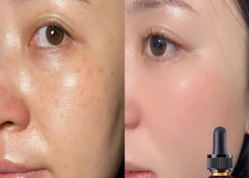 Discover the Best Alcohol-Free Facial Oil for Hydrated, Radiant Skin