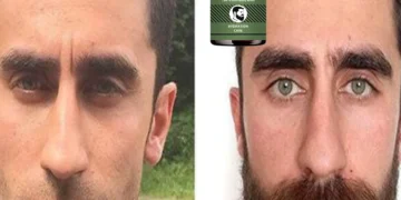 Top Beard Oils to Moisturize, Strengthen, and Boost Healthy Growth Quickly